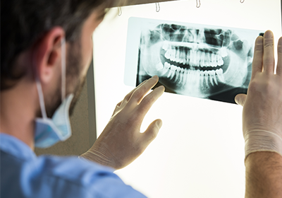 dentist-examining-dental-x-ray